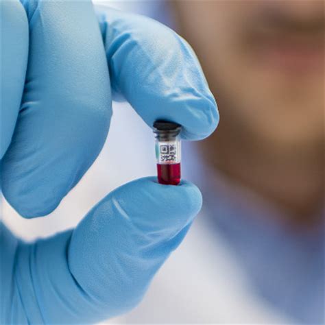 one drop blood test|one drop diagnostics.